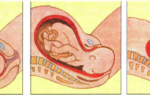 Беременность и роды – биология