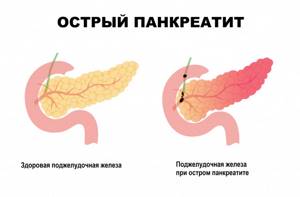 Органы полости тела
