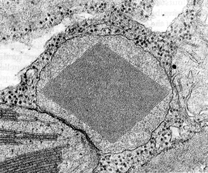 Аппарат Гольджи, лизосомы и другие органоиды цитоплазмы
