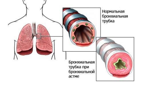 Болезни органов дыхания и их предупреждение, Биология